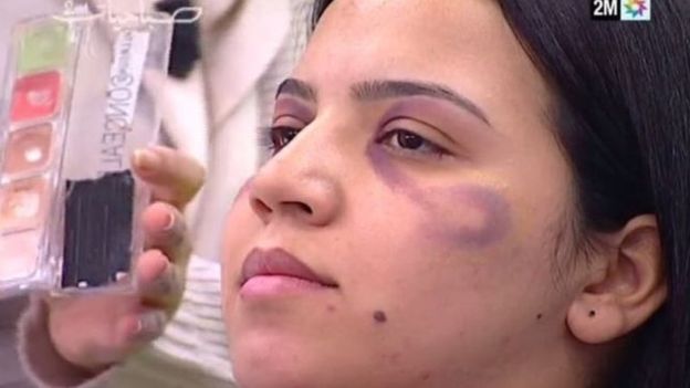 قناة مغربية تعتذر عن تعليم النساء كيفية إخفاء آثار العنف المنزلي