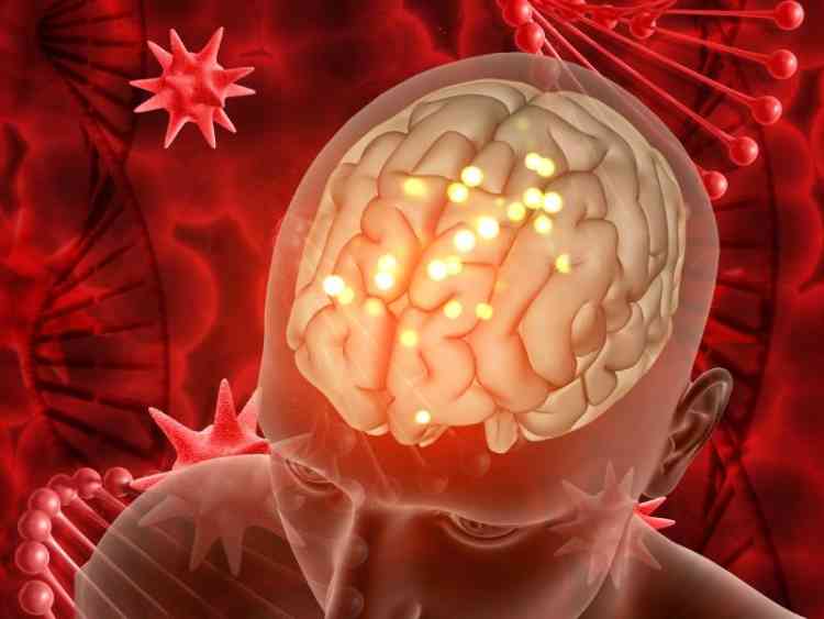 أسباب تمدد الأوعية الدموية في الدماغ.. أعراضها وأنماط علاجها
