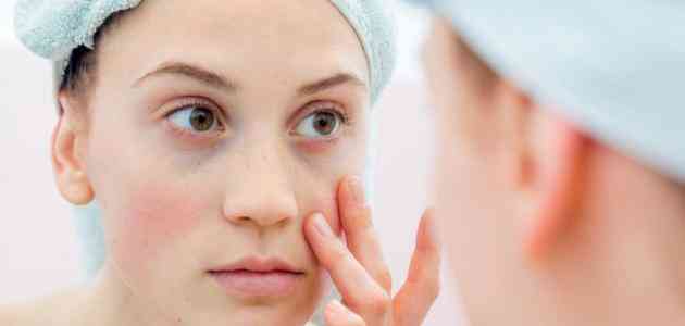 أسباب تورم الوجه وكيفية علاجه بخطوات منزلية بسيطة